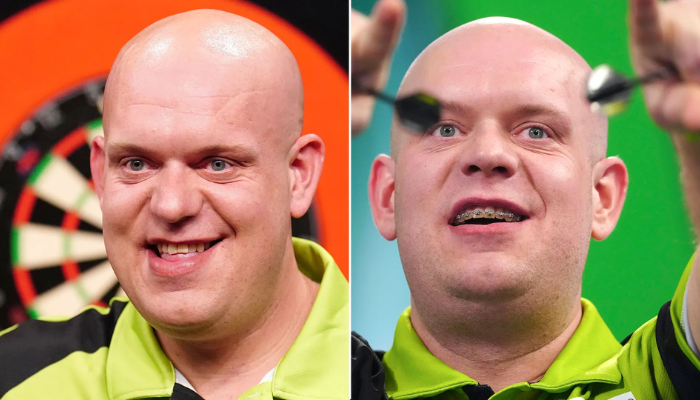 michael van gerwen teeth